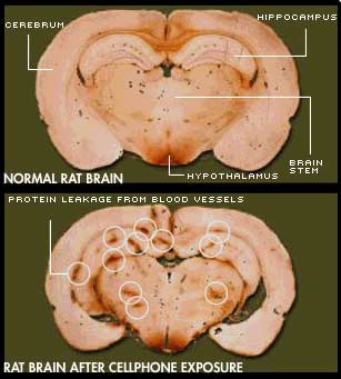 rat_brain_slaford